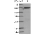 Recombinant Human PTK6/Brk Protein (GST Tag)