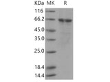 Recombinant Human PLK1/PLK-1 Protein (His Tag)(Active)