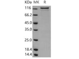 Recombinant Human PKC nu/PRKD3 Protein (GST Tag)