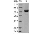 Recombinant Human DOPA Decarboxylase/DDC Protein (His Tag)(Active)