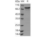 Recombinant Human CHK1/CHEK1 Protein (GST Tag)(Active)