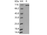 Recombinant Human PKC iota/PRKCI Protein (GST Tag)