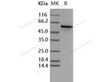 Recombinant Human BMPR1B/ALK-6 Protein (aa 149-502, His&GST Tag)