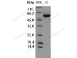 Recombinant Human TGFBR1/ALK-5 Protein (aa 200-503, His & GST Tag)(Active)