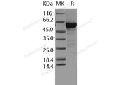 Recombinant Human MKK6 Protein (207 Ser/Asp, 211 Thr/Asp, His & GST Tag)(Active)