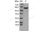 Recombinant Human MKK6 Protein (His & GST Tag)