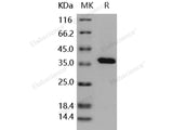 Recombinant Human PTP1B/PTPN1 Protein (His Tag)(Active)