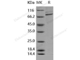 Recombinant Human CSF1R/CD115 Protein (His & GST Tag)