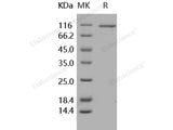 Recombinant Human RSK4/RPS6KA6 Protein (GST Tag)