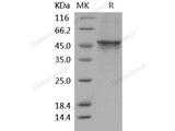 Recombinant Human GSK3B Protein (His Tag)(Active)