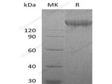 Recombinant Human VEGFR2/Flk-1/KDR Protein (His &GST Tag)(Active)