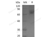 Recombinant Human EGFR/ErbB1 Protein (aa 668-1210, His&GST Tag)(Active)