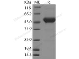 Recombinant Human CD90/THY-1 Protein (Fc Tag)