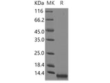 Recombinant Human CCL8/MCP-2 Protein (Yeast, His Tag)