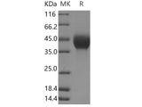 Recombinant Human TGFB1 (LAP)/TGF-beta 1 Protein (His Tag)