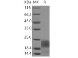 Recombinant Human PDGF-BB Protein (His Tag)(Active)