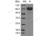 Recombinant Human PD-L1/B7-H1/CD274 Protein (ECD, Fc Tag)(Active)