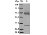 Recombinant Human IL-23(IL23A&IL12B Heterodimer) Protein (His Tag)(Active)