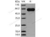 Recombinant Human MGAT5/GGNT5 Protein (His Tag)(Active)