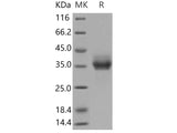 Recombinant Human EpCAM/TROP-1 Protein (His Tag)(Active)