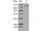 Recombinant Human Periostin/OSF-2 Protein (His Tag)(Active)