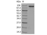 Recombinant Human CD31/PECAM1 Protein (Fc Tag)(Active)