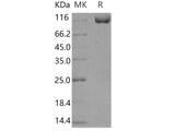 Recombinant Human DPP4/DPPIV/CD26 Protein (Fc Tag)(Active)