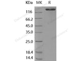 Recombinant Human ACE2 Protein (Fc Tag)(Active)