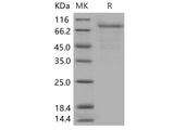 Recombinant Human CSF2RA/GM-CSFR Protein (Fc Tag)(Active)