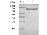 Recombinant Human LAG3/CD223 Protein (Fc Tag)