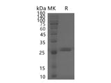 Recombinant Human PF4V1 Protein (Fc Tag)