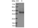 Recombinant Human PRRG2 Protein (Fc Tag)