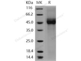 Recombinant Human CD19/Leu-12 Protein (His Tag)