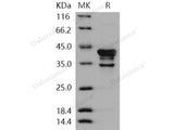 Recombinant Human CAMK1/CaMKI-alpha Protein