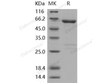 Recombinant Human ACK1/TNK2 Protein (GST Tag)