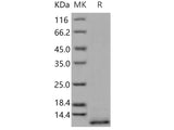 Recombinant Human CD9/Tspan-29 Protein (His Tag)