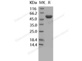 Recombinant Human TIMP2/TIMP-2 Protein (Fc Tag)