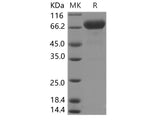 Recombinant Human Interleukin-12/IL-12 Protein (His Tag)