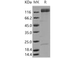 Recombinant Human ITGA5 & ITGB1 Heterodimer Protein