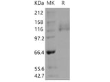 Recombinant Human ITGA6 & ITGB1 Heterodimer Protein