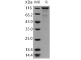 Recombinant Human EPOR & CD131 Homodimer Protein (Active)