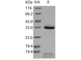 Recombinant Human FCGRT & B2M Heterodimer Protein (Active)