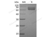 Recombinant Human FGFR3/CD333 Protein (alpha IIIb, His Tag)