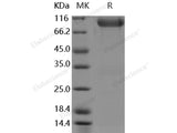 Recombinant Human FGFR3/CD333 Protein (alpha(IIIb), Fc Tag)