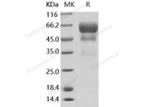 Recombinant Human PSAP/Prosaposin Protein (His Tag)