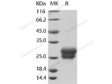 Recombinant Human Frizzled-4/FZD4 Protein (His Tag)