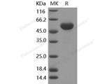 Recombinant Human Frizzled-4/FZD4 Protein (Fc Tag)