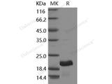 Recombinant Human GH1/Growth hormone 1 Protein (Active)