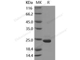 Recombinant Human GKN1/Gastrokine 1 Protein (His Tag)