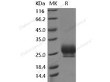 Recombinant Human RNF43 Protein (His Tag)